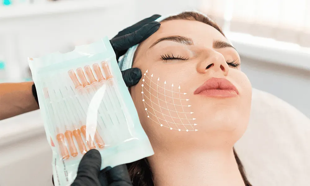 Needle-Free Thread Lifting